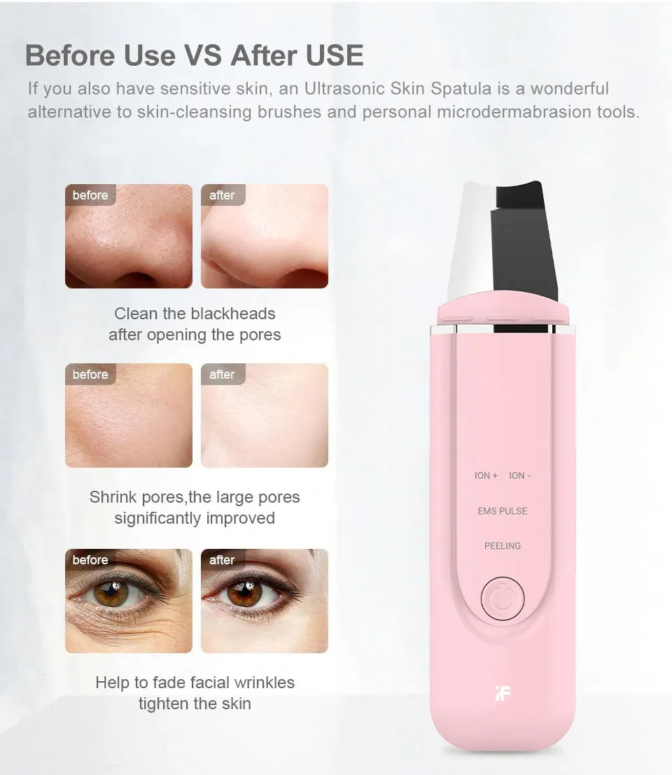 Bodimodi Ultrasonic Face Pore Cleanser